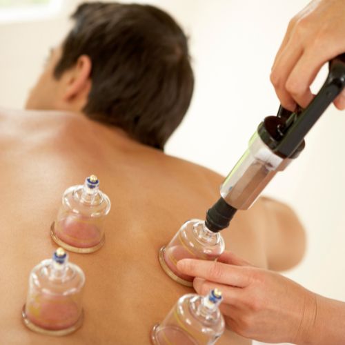 Best Cupping Therapy at Joint Efforts Physiotherapy clinic in Noida