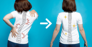 The Schroth Method for Scoliosis is a personalized, non-invasive physical therapy technique designed to address each individual's specific spinal curvature.