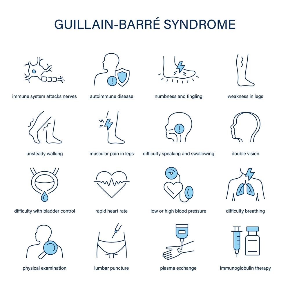 Graphic showing early Guillain-barre Syndrome signs: leg weakness, sensory loss, and diminished deep tendon reflexes.