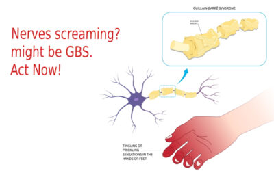 Guillain-Barré Syndrome: Essential Guide