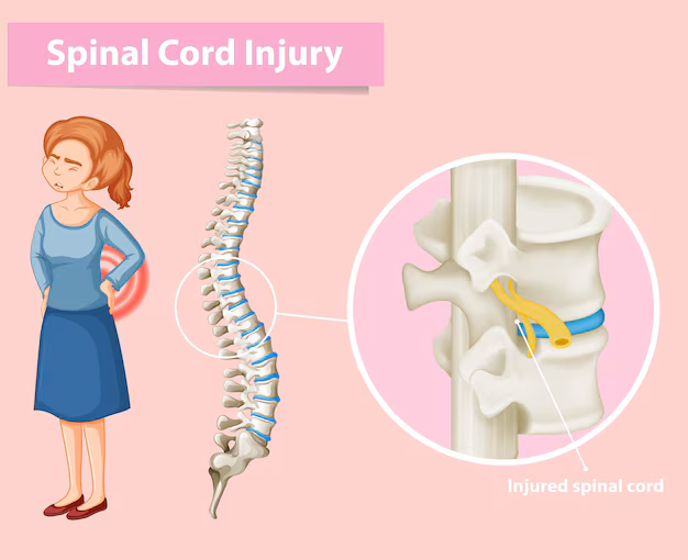Spinal cord injury causes severe damage to body symmetry. 